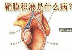 到底什么是鞘膜积液